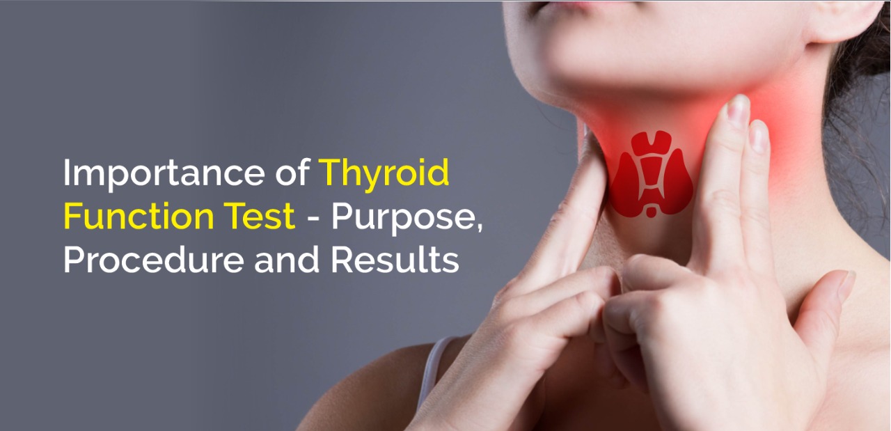 Thyroid Package Profile